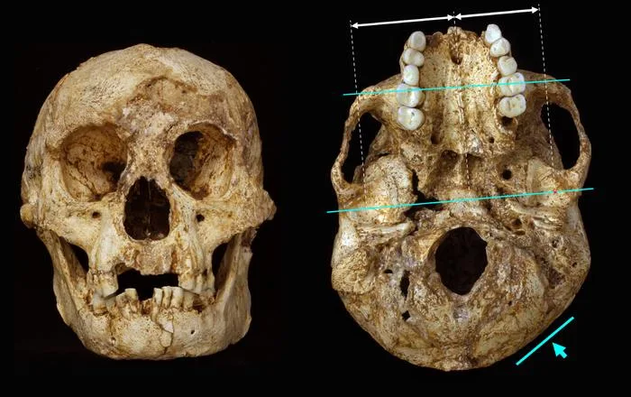 赤ちゃんが超泣き虫だったのは昔から？30万年前のホモ・エレクトスも頭の形で証明